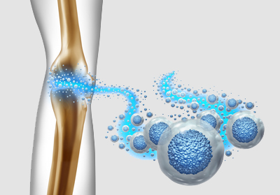 Knee Healing with PRP Therapy